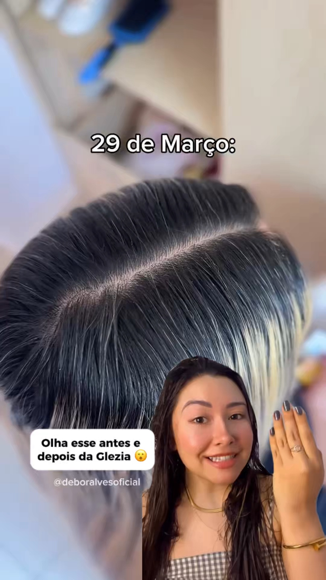 Fiquei chocada com esse antes e depois 😳 Estou testando o novo tônico e hoje vou medir com a fita métrica! To postando todos os dias nos stories, 30 dias usando e dando dicas! ✨

Quer testar também? Comenta EU QUERO 👇 

Grupo vip do insta: https://www.instagram.com/channel/AbbwU-pOy6Nh41cj/?igsh=MXc0OTNrZzl0Y3c3Mw== 
Grupo vip do whats: https://chat.whatsapp.com/KmRYJ1kntxKAYFOZ5DEkpr?mode=gi_t 

#fioterapia #cabeloliso #progressiva #lisoperfeito #goldspellcosméticos

#LTKpromo #LTKbrasil #LTKbeleza
