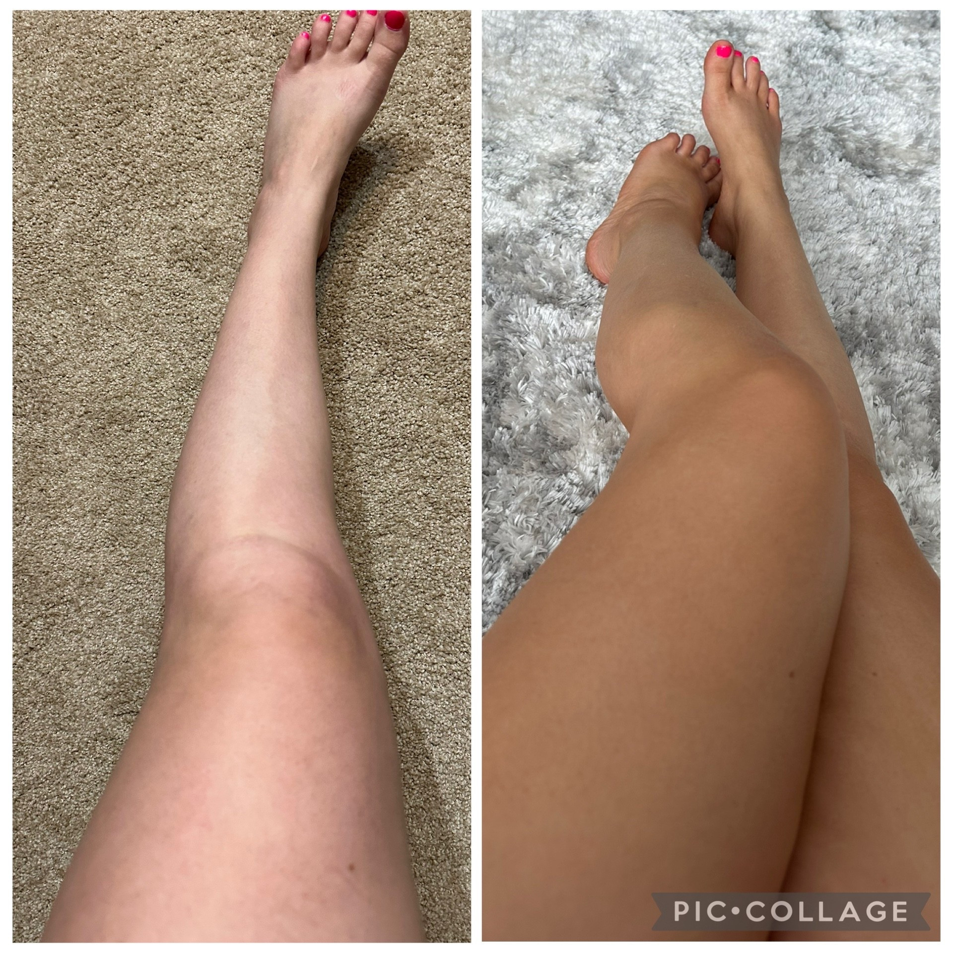 A little glow goes a long way ✨
This self-tan routine has been my secret for feeling confident without makeup or effort.
Sharing exactly what I use — linked here 🤍

#LTKselfcare #LTKBeauty #LTKgrwm