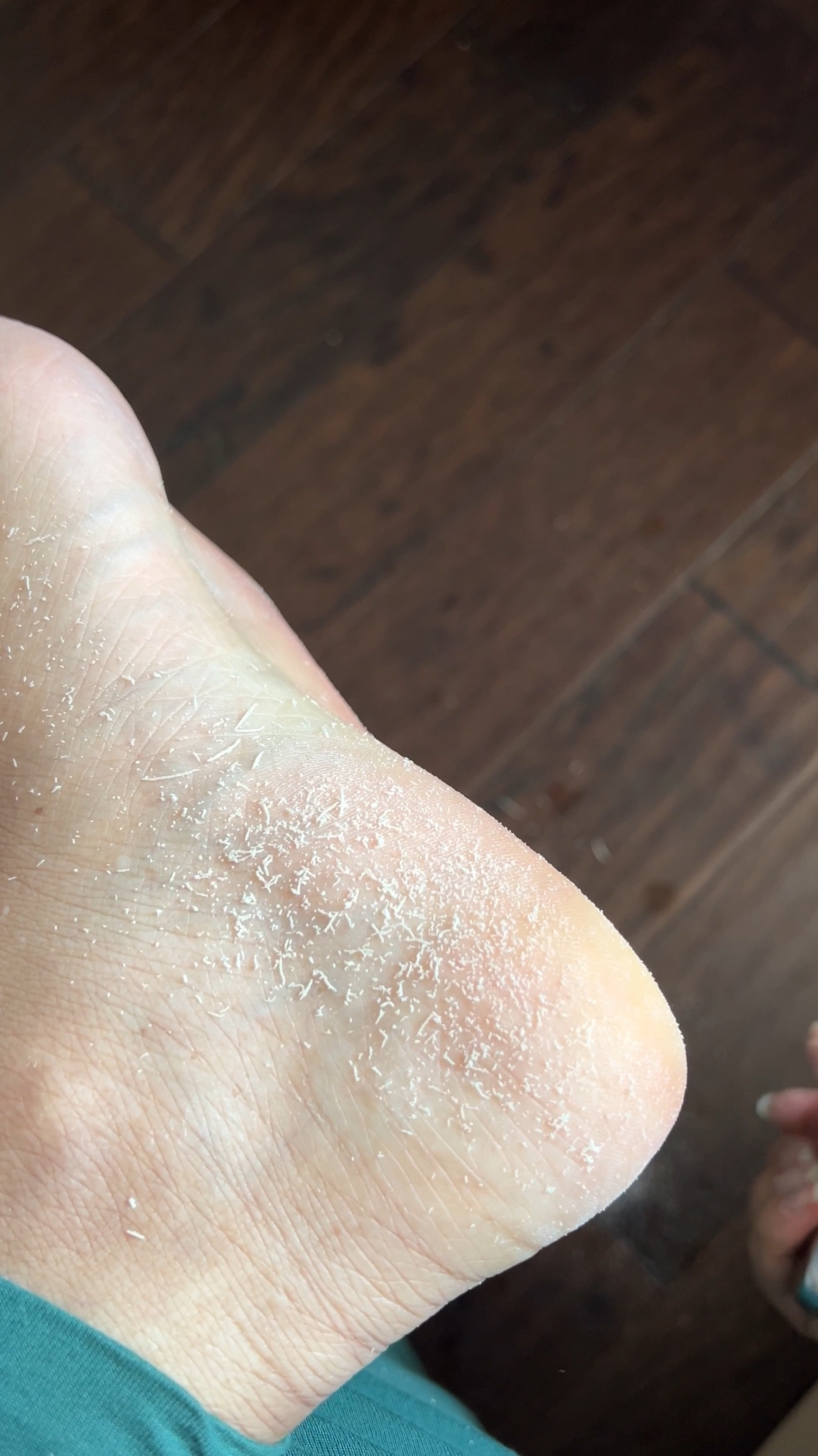 5 step pedicure routine for perfect soles

1. soak in warm water to soften calluses, dead skin, and cuticle
2. use a double sided foot file, starting with the coarse grit (pat feet dry first so they’re damp but not wet)
3. use the fine grit side to smooth the areas youve gone over
4. use a manual scrub the polish the top and bottom of the feet
5. do an oil bath, using your favorite oil with silicone socks to lock in moisture 
