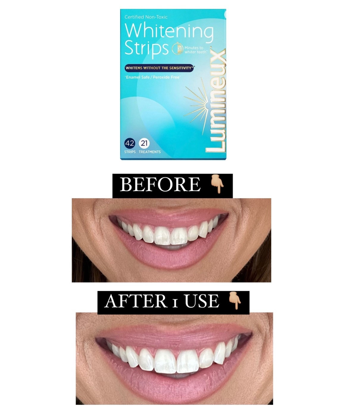The best non-toxic whitening strips on sale for prime day!!
