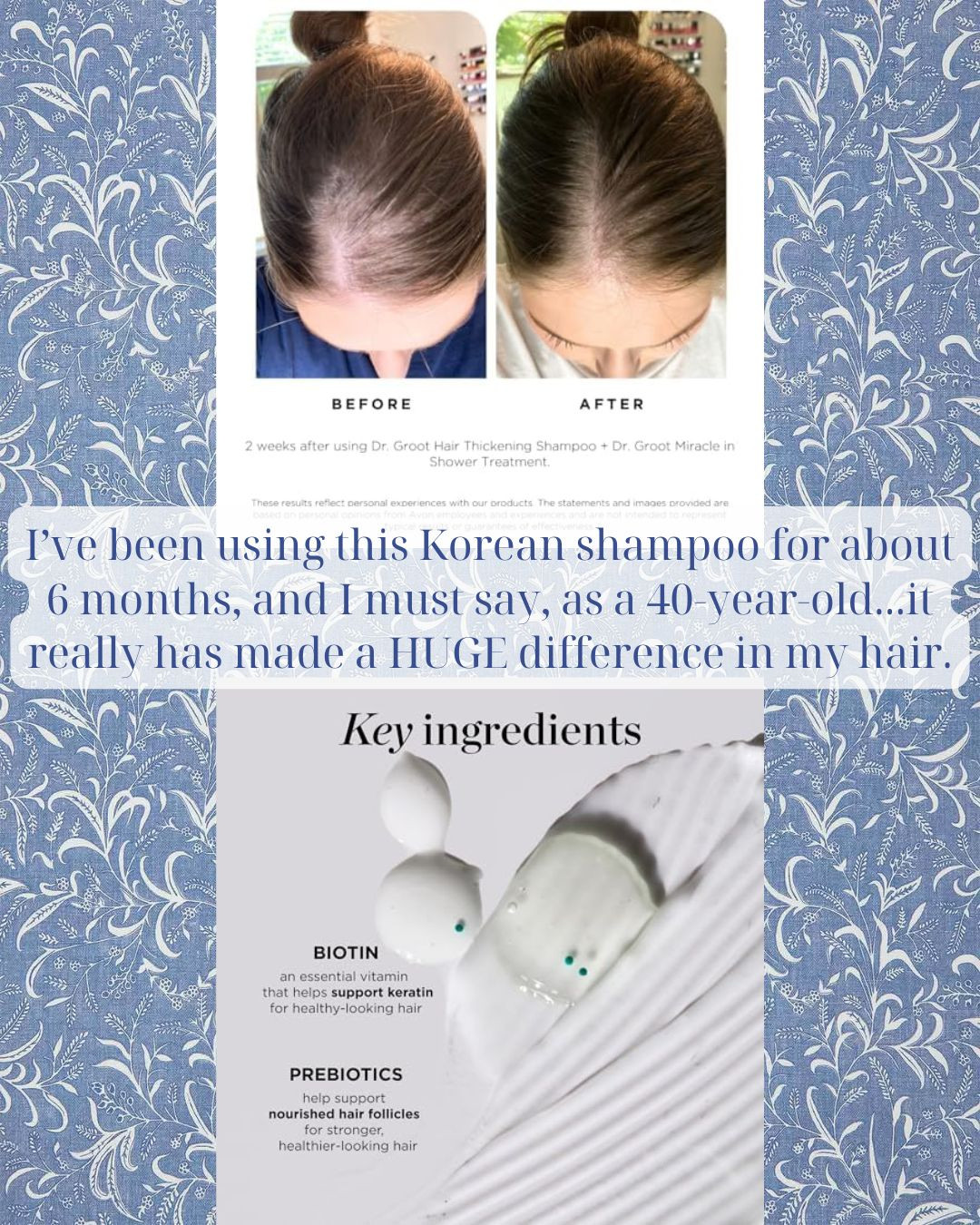 The best Korean shampoo for hair growth/density on Amazon! 

 #LTKBeauty