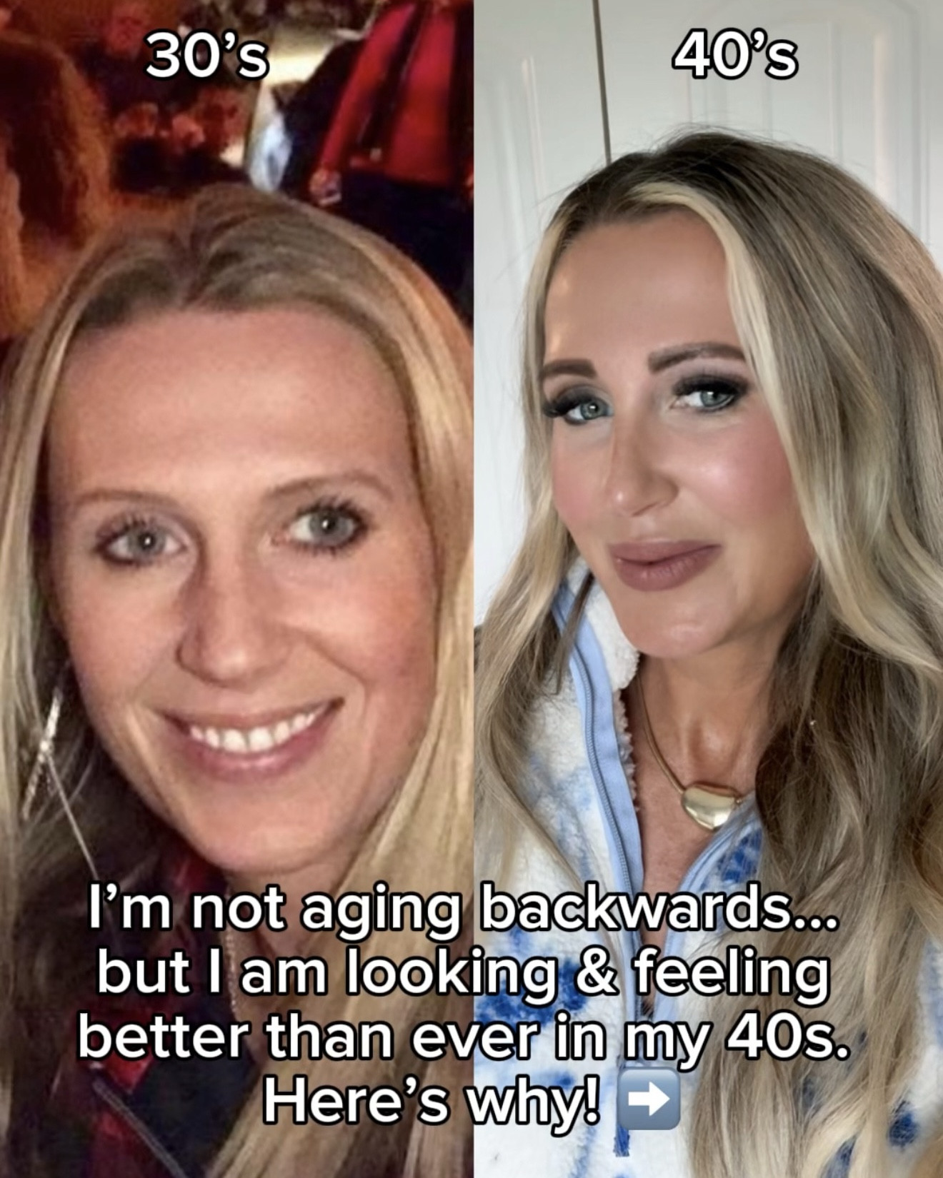 Use code: HOLLYR at checkout for the 10 minute loving tan!! The best self tanner you’ll ever use! 

I’m not aging backwards… but I am looking and feeling better than ever in my 40s. Here’s why. ✨

No gatekeeping here! I wish someone had shared these tips and tricks with me sooner.
.
.
.
B*tox in a stick, best facial Amazon finds, tint your own brows, best self tanner, 10 min self tanner, drugstore makeup finds, best under eye cream, body blur Amazon, natural teeth whitener, best facial toners, contouring chin face mask, lash serum, babe lash, #babeoriginal #babepartner #babeintarget #lashserum

#LTKselfcare #LTKBeauty #LTKmorningroutine