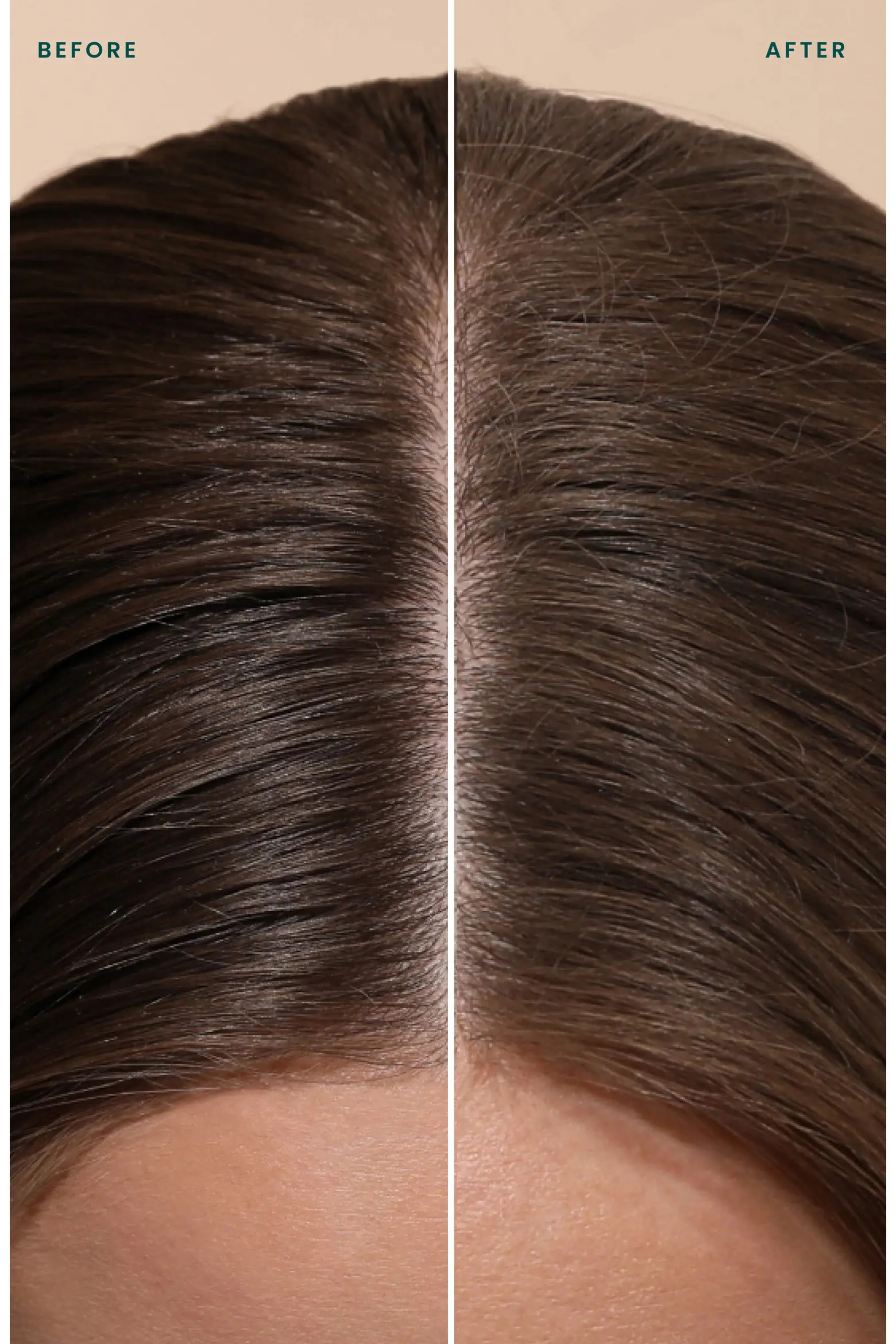 Detox Original Scent Dry Shampoo $44 Value (Women) | Nordstrom | Nordstrom