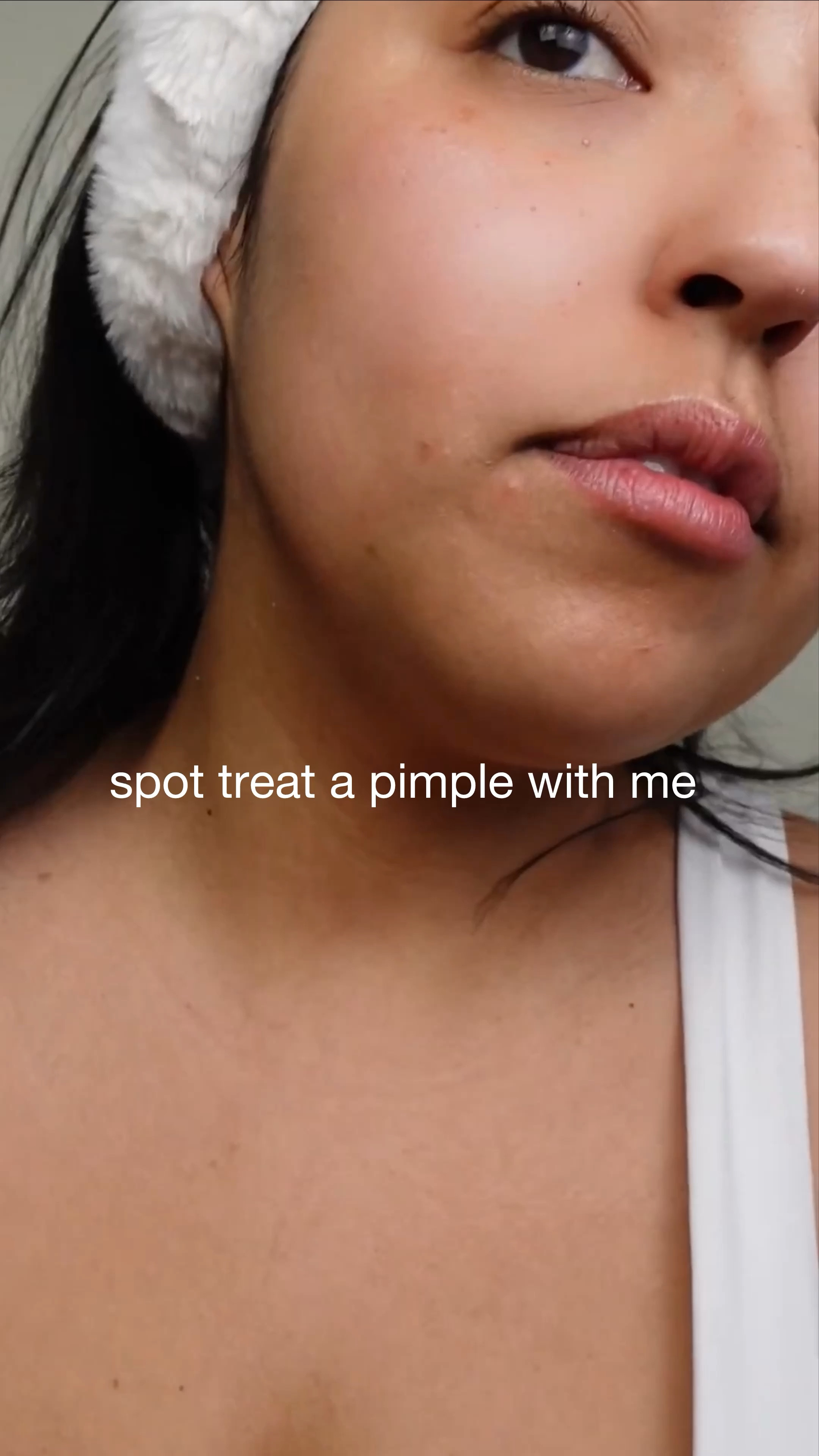 Spot treat my pimple
with me 


#LTKbeauty #LTKVideo
