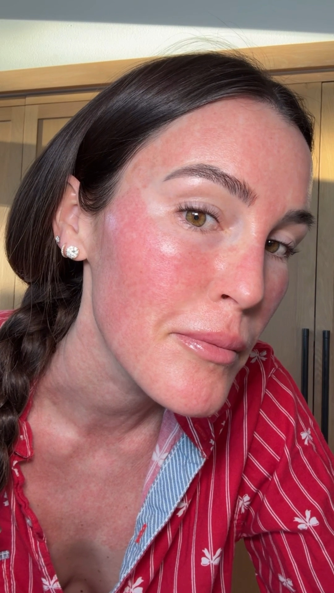 Day 2 after CO2 laser - face ice mask please!!

Skincare
Beauty 

#LTKBeauty