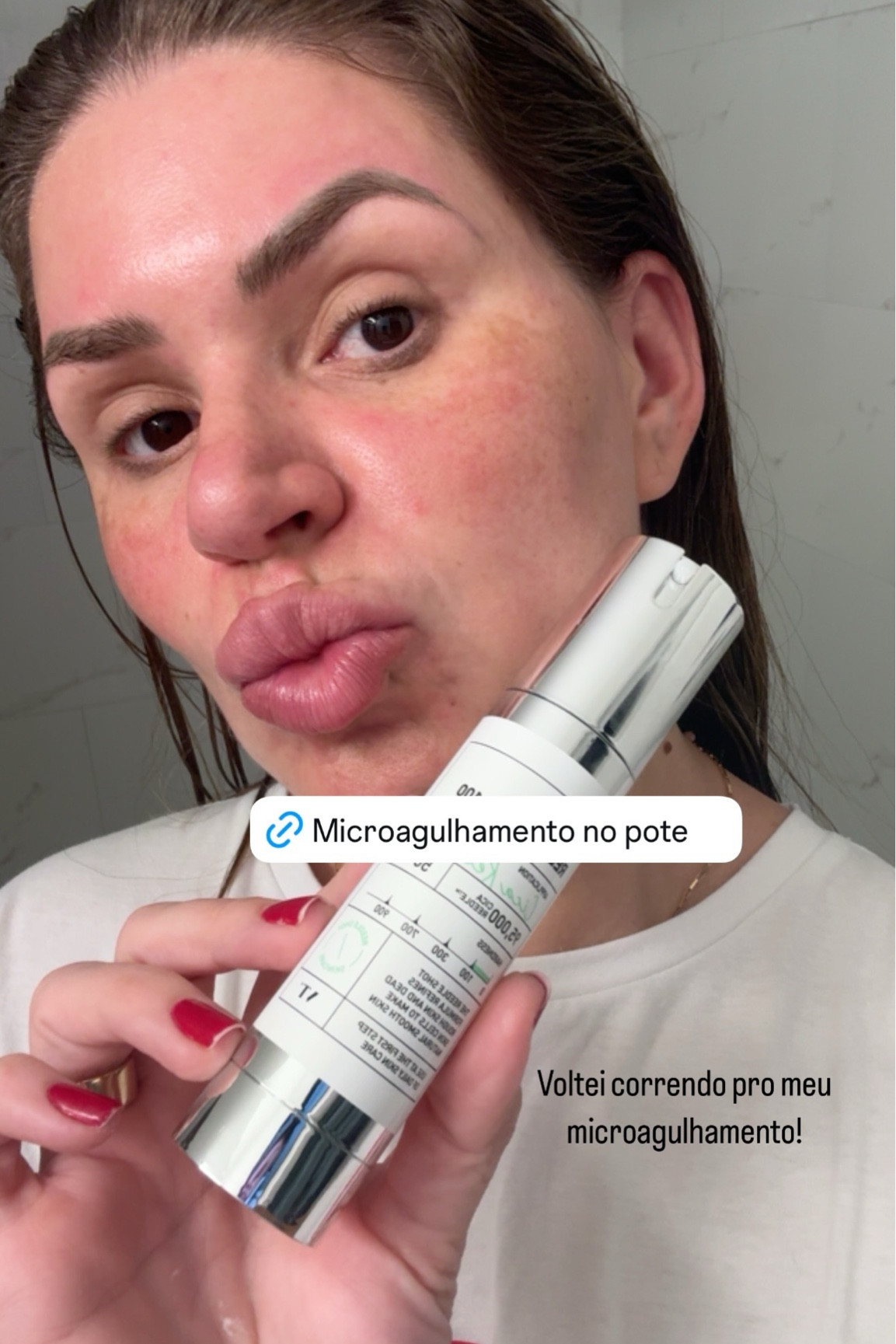 Cream Microneedling 

Daily Face Essence for Soft Skin, Centella Complex, Hyaluronic Acid, Green Propolis Extract for All Skin Types

#LTKBeauty #LTKOver40 #LTKWedding