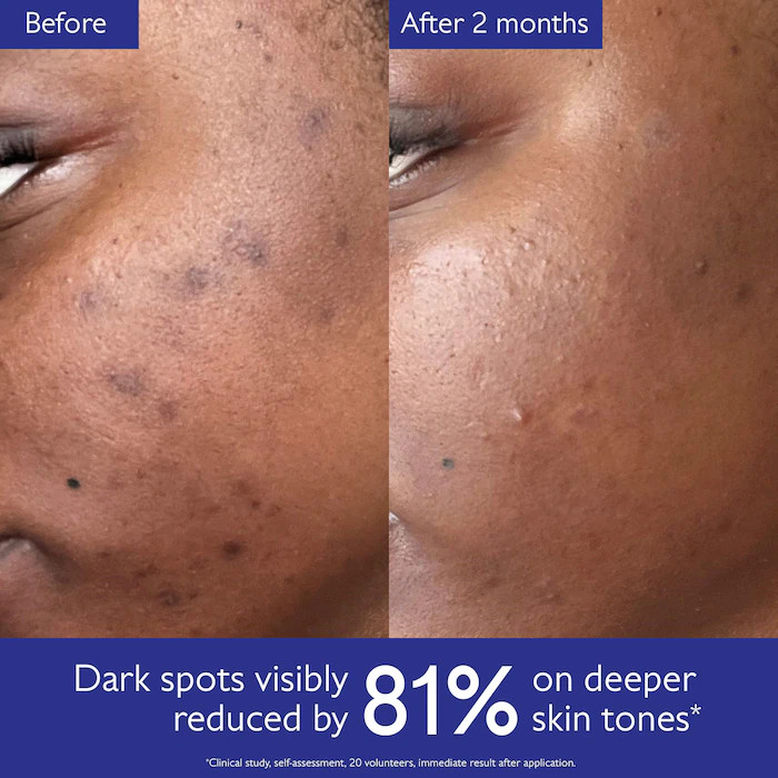 Vinoperfect Brightening Dark Spot Serum Vitamin C Alternative | Sephora (US)