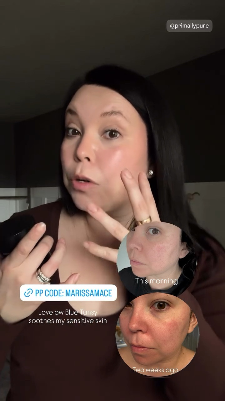 This morning Two weeks ago Love ow Blue Tansy soothes my sensitive skin

Primally Pure code: MARISSAMACE 

#LTKstorytime #LTKselfcare #LTKBeauty