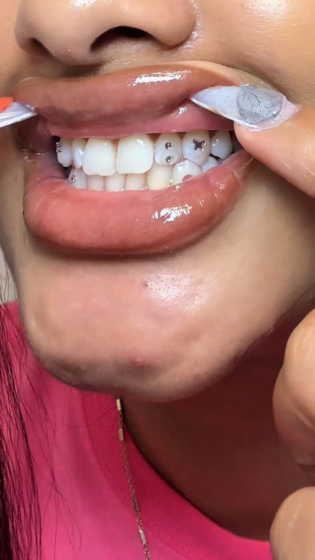 Tooth gem tutorial 😍 loveddd tgese 10/10

#LTKFindsUnder100 #LTKFindsUnder50 #LTKBeauty